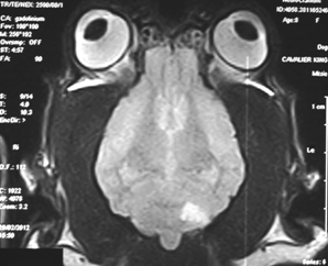 MRI scan of CKCS with cerebellar infarct - dorsal view