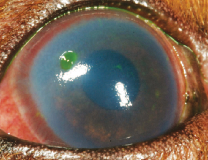 Corneal ulcer due to dry eye condition