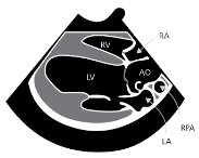 Echocardiogram Diagram
