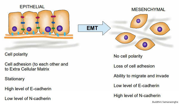 Epithelial to Mesenchymal Cell Transition