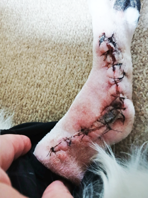 Sam's ankle surgery